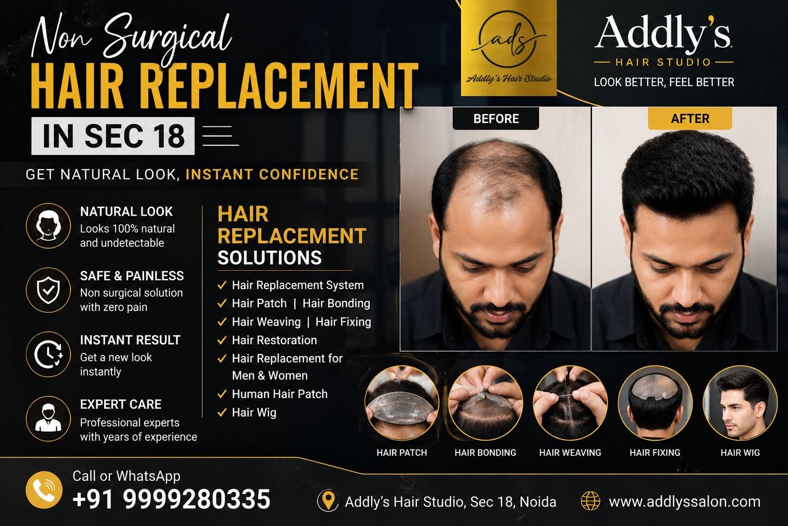 Professional Non Surgical Hair Replacement Sec 18 at Addly's Hair Studio showing a natural-looking hair replacement solution for an individual experiencing hair thinning.